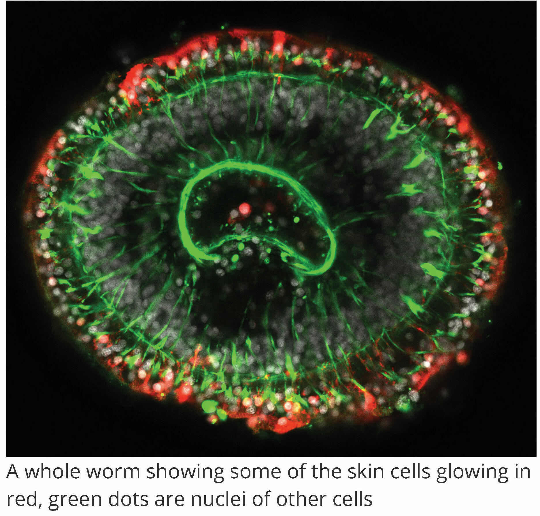 A whole worm showing some of the skin cells glowing in red, green dots are nuclei of other cells. Image by Lorenzo Ricci